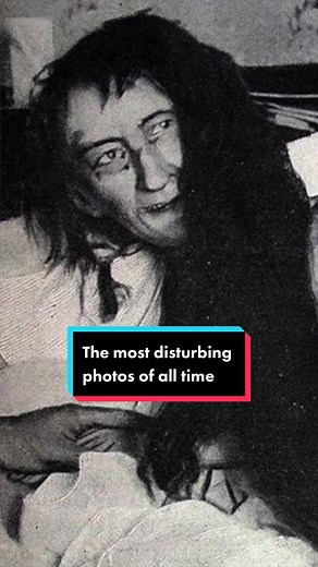 The most disturbing photos of all time #history #scary #horror #disturbing #fyp