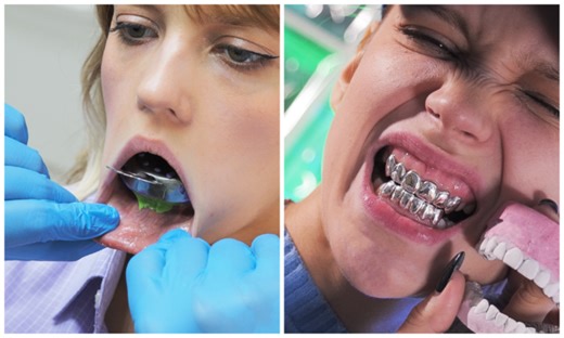 Jewelry overlay on teeth for a pretty girl