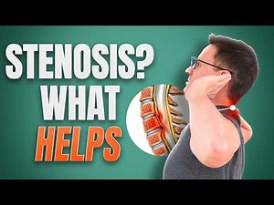 Cervical Stenosis: 5 SAFE Neck Exercises That Actually Help (Avoid These Mistakes)