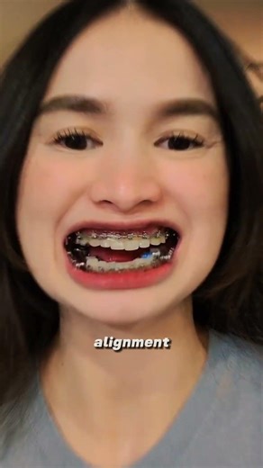 Why Does She Have Shocks on Her Teeth