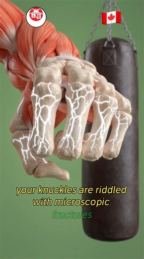 Wolfe’s Law. Bones get harder the more you use them.! 🤨