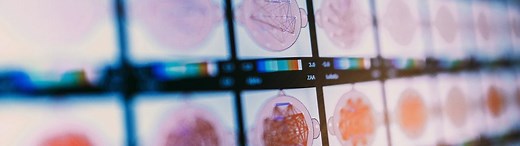 Here's what the age of AI means for the world, according to Bill Gates