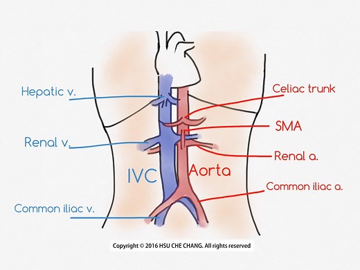 [Sonoanatomy] IVC - POCUS Academy