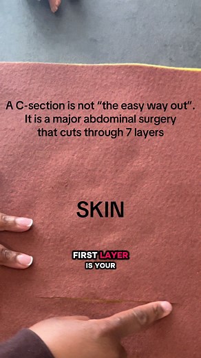 C-sections are not the easy way out. They are a major abdominal surgery that brings a baby into the world while your body heals through multiple layers 🤍 We are talking skin, fascia, muscle separation, and the uterus. Every single layer has to recover, reconnect, and learn how to function again. To every C-section mama, you are strong, resilient, and doing something incredible. This is not the easy way. This is a powerful way 👏 A few things your body will thank you for: 💫 Start with gentle br