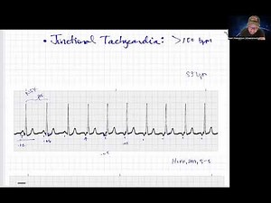 Quick Junctional Rhythms Review- Paramedic Cardiology