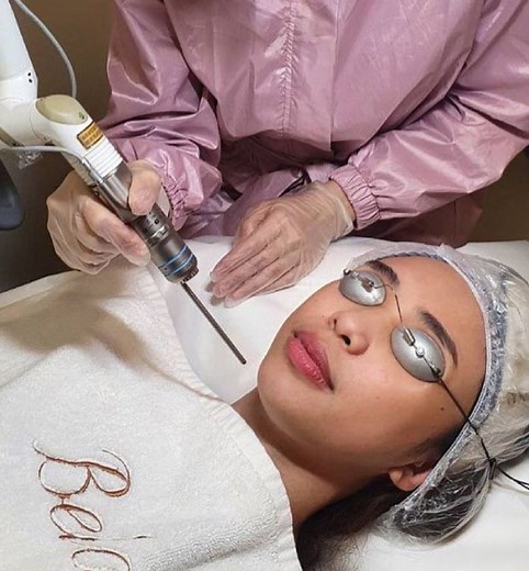 Angel Whitening Laser