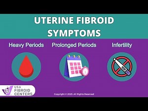 The Signs and Symptoms of Uterine Fibroids