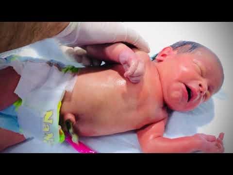 Why Premature Babies Often Cry During Massage 💞🩺 | NICU Care Guide 👶 | Emotional Educational Video