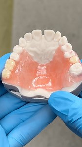 Posterior Flexi Partial! Case from Dr. Jame Whatley in Alabama! Alabama Family Dental - Dr. James Whatley | Luke Kahng