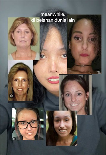 Penyintas Scleroderma dan Cerita Menarik Kembarnya