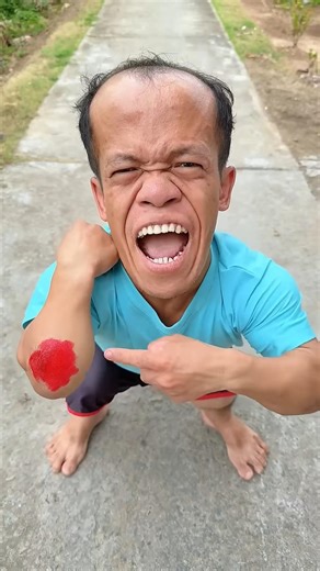 Please !!! Help me 💉💊🩹 #subcribe