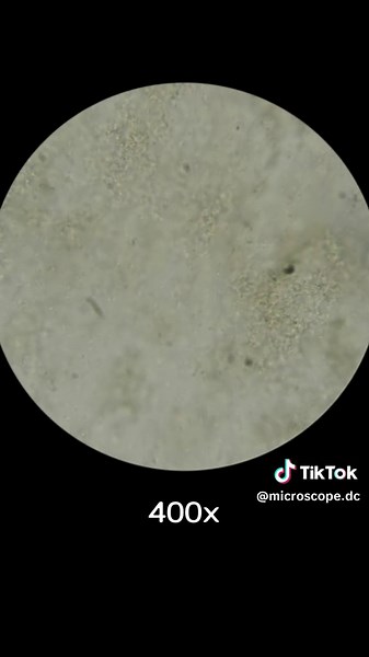 Yakult and Probiotics Capsule Under Microscope