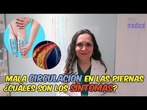 Poor leg circulation: symptoms 🏃🕺 / Dr. Melissa Tejeida