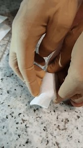 Applying Bandage On Injured Toe Stock Footage Video (100% Royalty-free) 3670555463 | Shutterstock