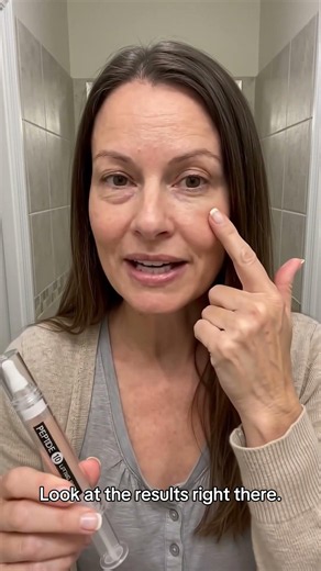 Watch This Serum Instantly Lift Hooded Eyes & Under-Eye Bags (Live Demo)