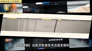 dicom格式怎么转换？dicom下载？radiant官网？