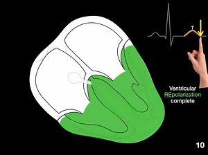 🧠✨ The Heart’s Electrical Symphony: ECGs & Action Potentials ✨🧠 Ever wondered how an ECG captures your heart’s electrical dance? Dr. David Morton, @TheNotedAnatomist ," breaks it down perfectly! Here’s how ECG waves sync with your heart’s action potentials: --- 📈 ECG Waves Decoded: 🔹 P-Wave: Atrial depolarization (SA node firing). 🔹 PR Segment: A quick pause for atrial contraction. 🔹 QRS Complex: Ventricular depolarization (atrial repolarization hides here). 🔹 ST Segment: Ventricles fully