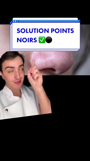 Comment éliminer les points noirs sur le nez ?