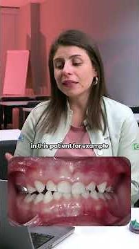 When’s the best time to use an anterior bite plate?