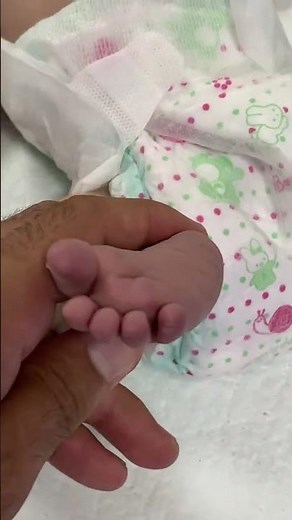 Birth Asphyxia & Cyanosis in NICU Babies | Causes, Signs & Care