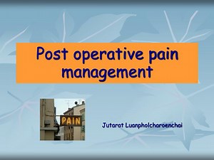 Post operative pain management - SlideServe