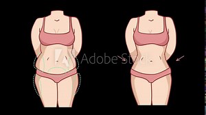 Female Body liposuction fitness slim body fat. fat body to slim body transformation. 4k cartoon animation