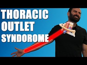 THORACIC OUTLET SYNDROME. BEST Exercises, Stretches & Advice for Neck & Arm Pain Relief