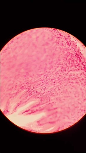 Exploring Stomach Lining Under a Microscope