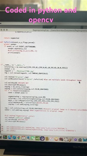 CT scan Lung Segmentation with Python and OpenCV