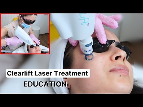 ClearLift Laser Skin Treatment For Perfect Skin-Tightening and Lifting