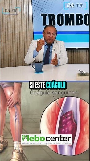 TROMBOSIS: La amenaza silenciosa que debes conocer ⚠️