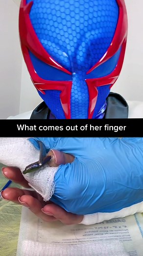 Real Venom Symbiote Finger Pulling Compilation