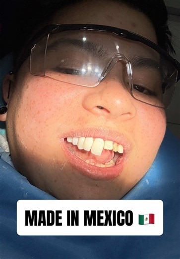 PART 2 After the most insane botched case straight from Mexico… we finally gave her the smile she went there for in the first place. #dentakay Price: $40,000
