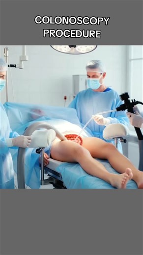 Colonoscopy Procedure Explained | The Camera That Goes Inside You And Saves Your Life! 2,778 #colonoscopy #coloncancer #coloncancerawareness #colonpolypectomy #medical3danimation