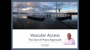 Vascular Access the Out-of-Plane Approach