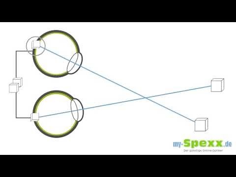 Was ist Schielen? (Strabismus)