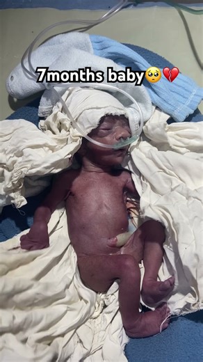 Life After the NICU | Our Preemie Baby at 7 Months 💕”#nicubaby #cutebaby #newbornbaby #doctor