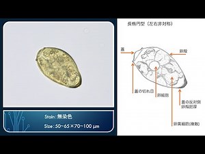[寄生虫かるた] ウエステルマン肺吸虫卵【豆構造解説：字幕】