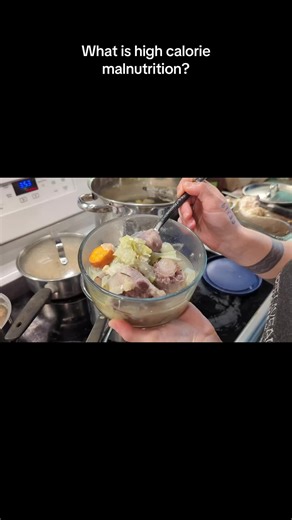 What is high calorie malnutrition? I teach a class every week where I take you through the fundamentals of nutrition with mast cell and histamine disorders as well as co occurring conditions in mind. Join Reaction Free under monthly subscriptions