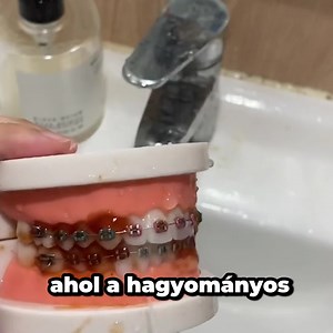 159 reactions · 14 shares |  Hagyja ki a hagyományos fogselymezést ezzel a vízsugárral. 醴 Hatékonyan tisztítja a nehezen elérhető helyeket. ✨ Könnyedén eltávolítja a lepedéket és ételmaradékokat. Rendeljen az alábbi gombra kattintva | Vigoexpress | Facebook