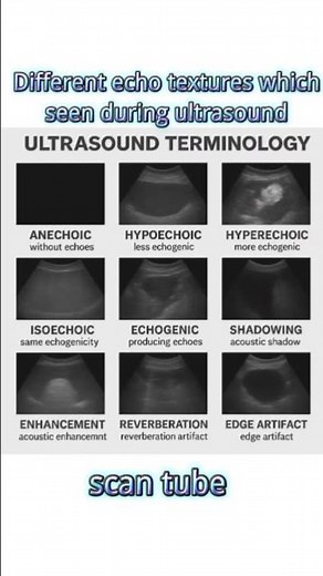 Ultrasound Echo Patterns: Quick Guide #ultrasound #scantube