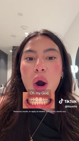 V34 Colour Corrector: Honest Review of Hismile Serum