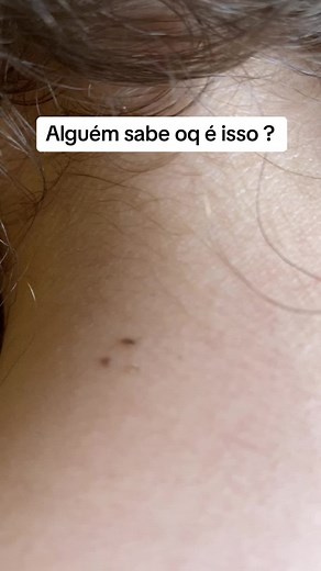 #piolho #fy #foyoupage
