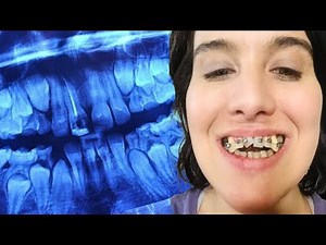 The Dental Scam That RUINED Lives...