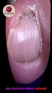 11K views · 58 reactions | Simple Tips for Seniors to Improve Foot Comfort  #WellnessNails #GentleToenailCare #SeniorNailCare | Bye | Facebook