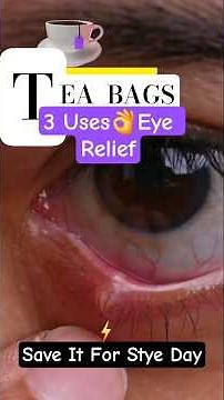 3 EYE PROBLEMS RELIEVED BY USED TEA BAGS #eyehealth #eyecare #kitchenhacks
