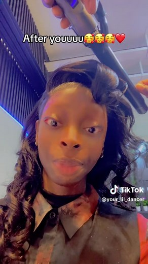 Understanding Scleroderma Symptoms and Experiences