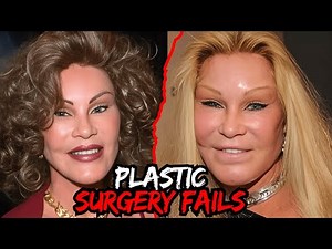 Shocking Celebrity Plastic Surgery Fails That Went Too Far
