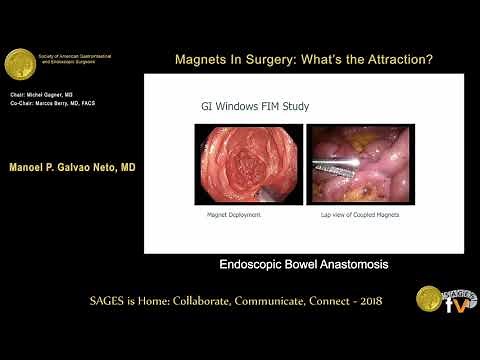 Endolumenal bowel anastomoses by using magnets