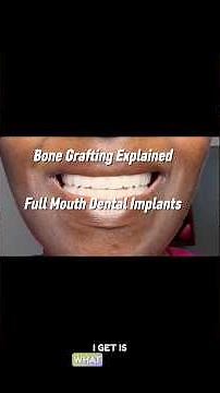 Bone Grafting Explained | Why I Needed It Before My Dental Implants (Episode 2)